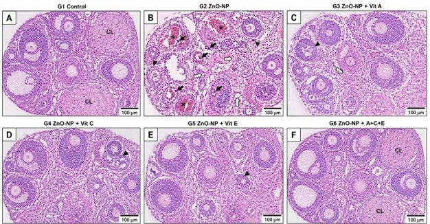 Fig. 1: Representative schematic photomicrographs of ovarian sections stained with haematoxylin and eosin (H&E, ×100). (A) G1 Control: normal architecture—follicles at all stages, intact corpora lutea (*), and organised stroma. (B) G2 ZnO-NP: severe vascular congestion (open arrows), widespread follicular atresia (arrowheads), stromal edema (♦), apoptotic bodies (filled arrows), and inflammatory infiltration. (C–E) G3, G4, G5: progressive histological recovery with decreasing lesion severity. (F) G6 ZnO-NP + A+C+E: near-complete architectural restoration resembling controls. Scale bar = 100 µm.
