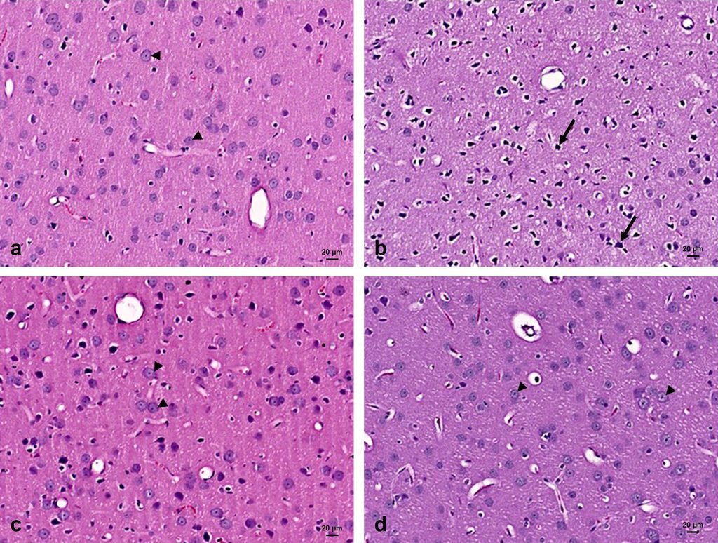 Fig. 2: Photomicrographs of the frontal cortex stained with Hx&E. A: Control section reveals the neurons with their pale cytoplasm and vesicular nucleus. B: The diabetic group shows that most of cells have dark cytoplasm and nucleus with pericellular halo. C: The caffeine treated diabetic group are showing many cells with pale cytoplasm and vesicular nuclei. There are few dark cells with dark nuclei. D: The caffeine group are showing mainly pale cells as well. X 200