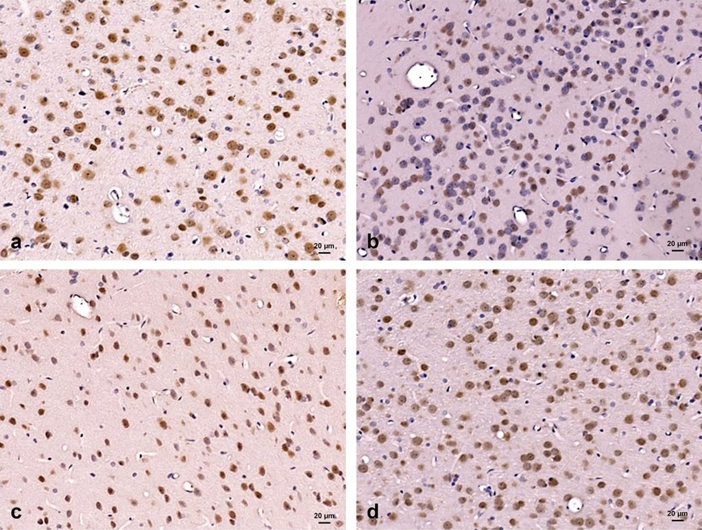 Fig. 3: Photomicrographs of the frontal cortex immunostained with anti-NeuN antibody (Neuronal marker). A: Control group is showing the immunoreactivity of neurons. B: Diabetic group displays a marked decrease in immunoreaction. C: Caffeine-treated diabetic group reveals a marked increase in immunoreactivity. D: Caffeine only treated animals show the positive staining of neurons. X 200.