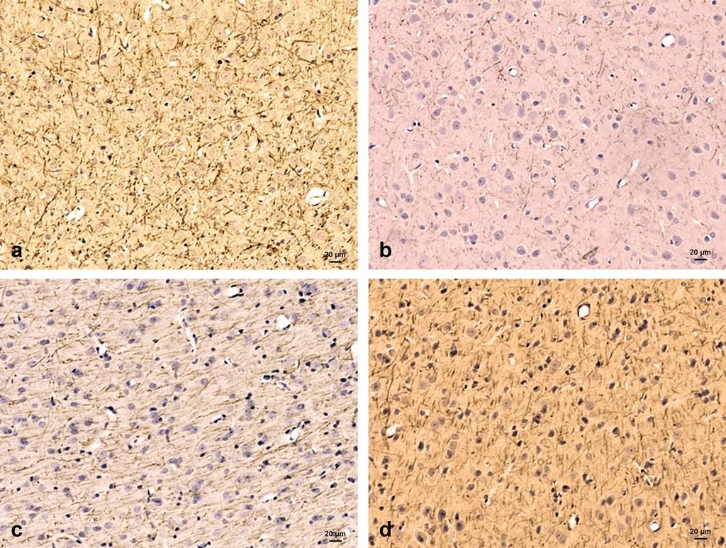 Fig. 4: Photomicrographs of the frontal cortex immunostained with anti-MBP antibody (Myelin marker). A: Control group shows the immunoreactivity of myelinated cells. B: Diabetic group shows a marked decrease in immunoreaction. C: Caffeine-treated diabetic group reveals a marked increase in immunoreactivity. D: Caffeine only treated animals show the positive staining of myelin. X 200