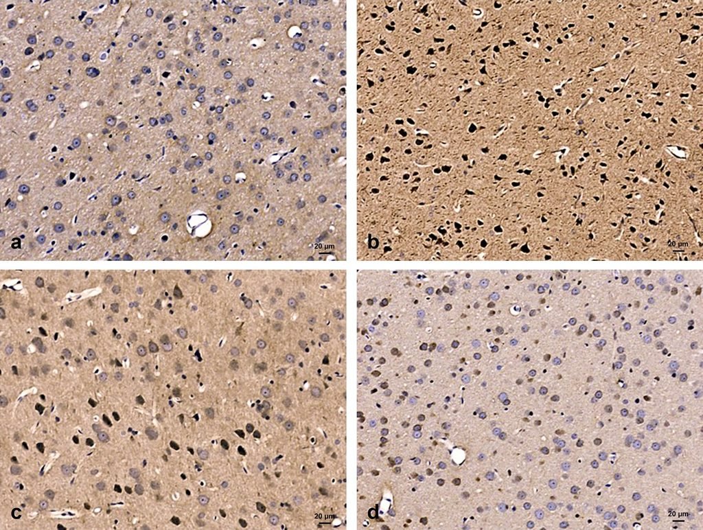 Fig. 5: Photomicrographs of the frontal cortex immunostained with anti-Bax antibody (Apoptosis marker). A: Control group shows no immunoreactivity of cells. B: Diabetic group shows a marked increase in immunoreaction. C: Caffeine-treated diabetic group reveals a decrease in immunoreactivity. D: Caffeine only treated animals show no staining similar to control. X 200