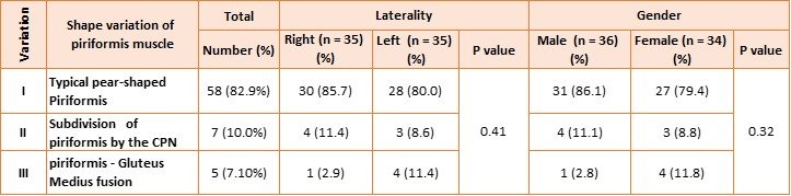 Table 2: Shape variation of piriformis muscle according to laterality and gender.