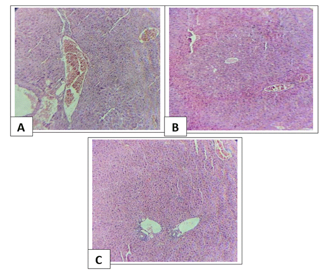 Fig. 4: [A] Liver treated with cadmium chloride only [H &E stain X100], [B]   Liver treated with cadmium chloride and 200 mg cardamom [H &E stain X100], [C] Liver treated with cadmium chloride and 300 mg cardamom [H &E stain X100].