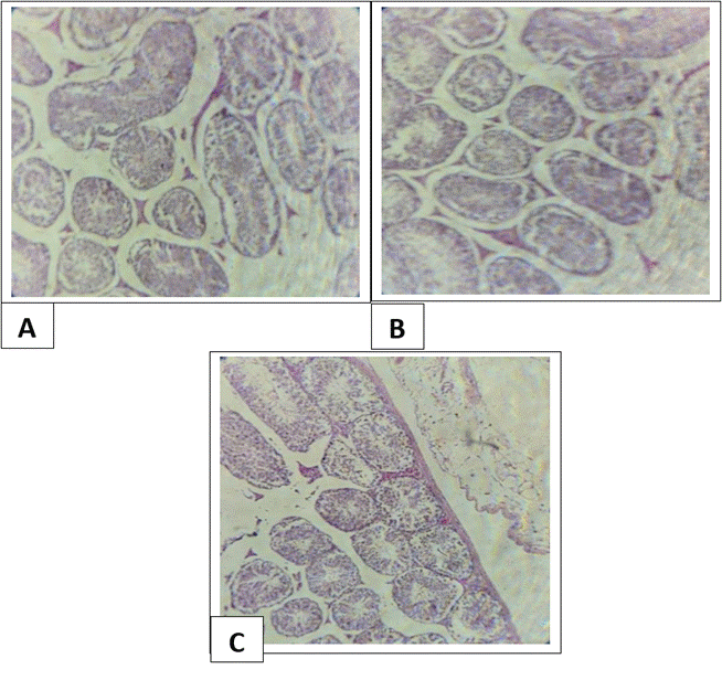 Fig. 2: [A] Testis treated with cadmium chloride only [H &E stain X400], [B] Testis treated with cadmium chloride and 200 mg cardamom [H &E stain X400], [C] Testis treated with cadmium chloride and 300 mg cardamom [H &E stain X400]