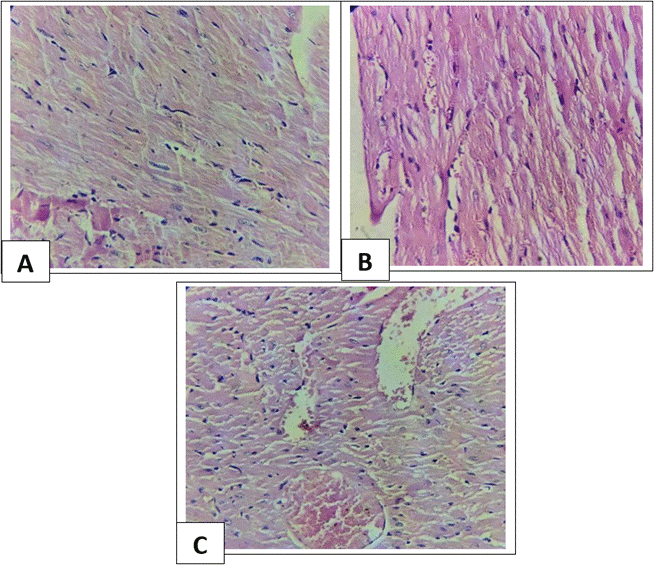 Fig. 3: [A] Heart treated with cadmium chloride only [H &E stain X400], [B] Heart treated with cadmium chloride and 200 mg cardamom [H &E stain X400], [C] Heart treated with cadmium chloride and 300 mg cardamom [H &E stain X400]