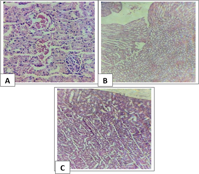 Fig. 1: [A] kidney treated with cadmium chloride only [H &E stain X400], [B] kidney treated with cadmium chloride and 200 mg cardamom [H &E stain X40], [C]  kidney treated with cadmium chloride and 300 mg cardamom [H &E stain X400]